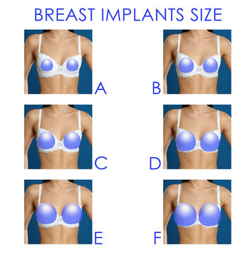 Collage with photos of woman demonstrating different implant sizes for breast on white background, closeup