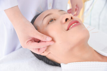 Beautiful asian woman receiving facial acupuncture treatment at clinic ,Alternative medicine concept.
