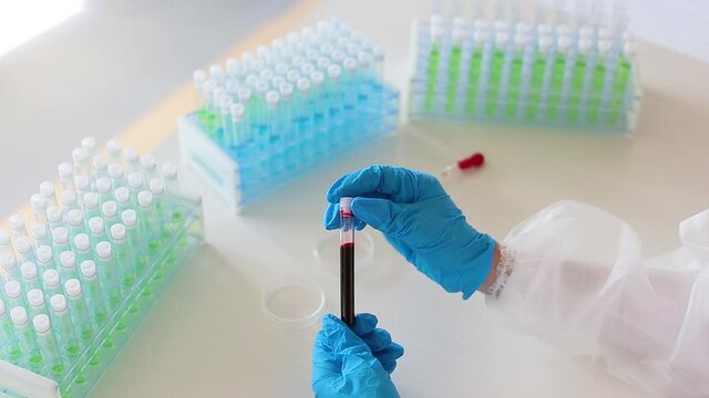 Close up view of a doctor in a white protective gloves looking on a blood sample in a test tube.