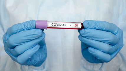 Positive test result COVID-19, novel coronavirus 2019 found in Wuhan, China. Test tube with a positive blood test for COVID-19. Laboratory study of a blood sample on COVID-19. Testing for 2019-nCoV.