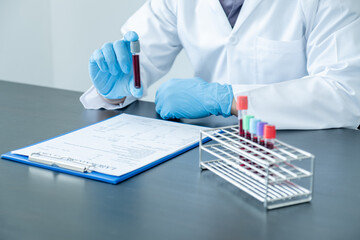 Professional doctors perform find virus tests from samples of blood tests to diagnose coronary...