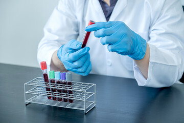 Professional doctors perform find virus tests from samples of blood tests to diagnose coronary...