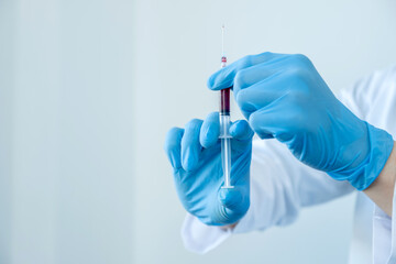 Professional doctors perform find virus tests from samples of blood tests to diagnose coronary...