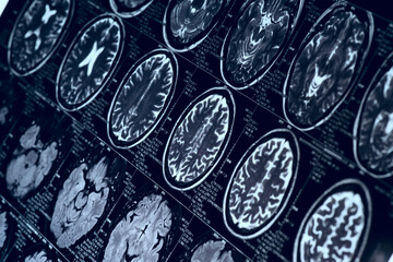 MRI scan of human brain, toned