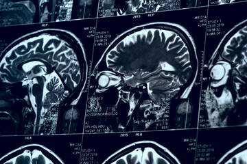 MRI scan of human brain, toned