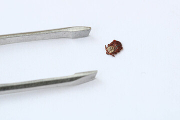 danger insect tick Ixodes persulcatus. Carrier Encephalitis virus or Lyme Disease. infected parasite hold metal tweezer