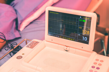 Cropped view of a heart monitor giving vital sign readings during an operation in operating room at the hospital. - obrazy, fototapety, plakaty