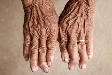 Closeup hand skin old. Skin background texture. Hands and fingers of the old man.