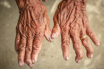 Closeup hand skin old. Skin background texture. Hands and fingers of the old man.