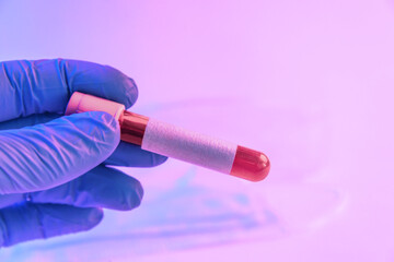Doctor hand in protective glove holding tube blood sample with blank label, copy-space.