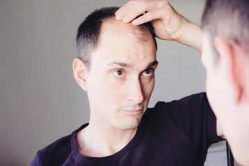 Young man looking at mirror worry about balding.