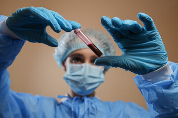 A doctor holds a test tube with a coronavirus positive blood sample. stop coronavirus. MERS....