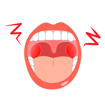 Oral throat health illustration