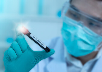 Close up Covid-19 blood sample test tube in scientist's hand.