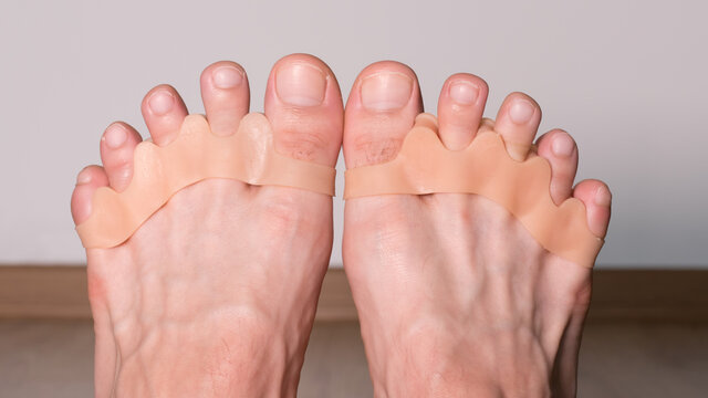 Hallux silicone finger corrector. Repair bent toes and relieves pain in the feet