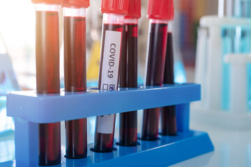 Asian Scientist working on blood test tube to analysis and develop vaccine of covid-19 virus in lab...