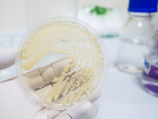 Yeast cultivation in medium agar plate for microbiology research laboratory