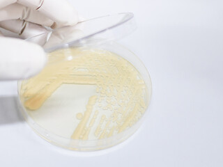 Fototapeta na wymiar Yeast cultivation in medium agar plate for microbiology research laboratory