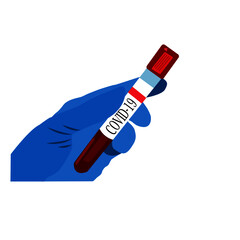 Hand that holds test tube with blood