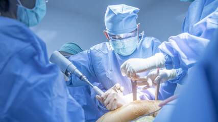 Team of doctor doing surgery inside modern operating room with orange effect. Asian orthopedic...