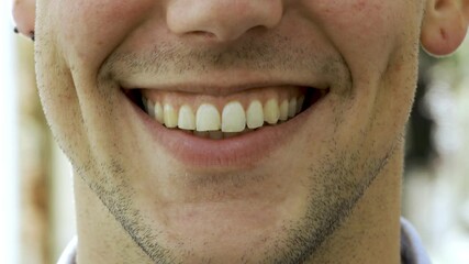 Lower face of young Caucasian man smiling at camera outdoors, posing, showing teeth. Front view, closeup, cropped shot. Human emotions or dental care concept