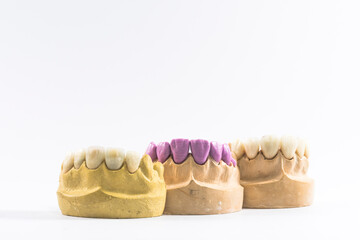 DIENTES