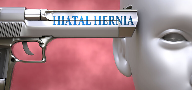 Hiatal hernia can be dangerous for people - pictured as word Hiatal hernia on a pistol terrorizing a person to show that it can be unsafe or unhealthy, 3d illustration