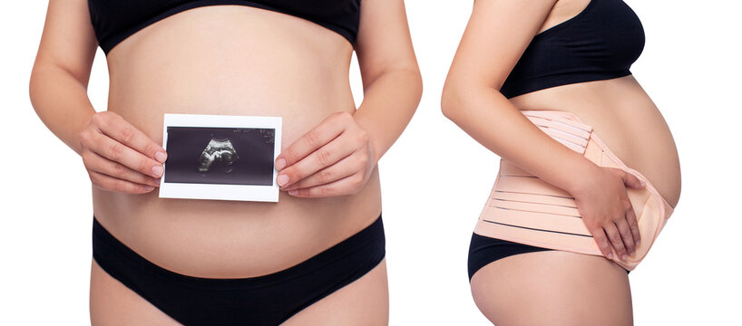 Collage of pregnant woman with ultrasound and abdominal bandage.