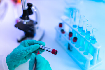 The scientist doctor created a vaccine against the coronavirus.Coronavirus 2019-nCoV Blood Sample. virus outbreaking.Technician holding blood tube test in the research laboratory