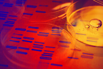 DNA fingerprints.