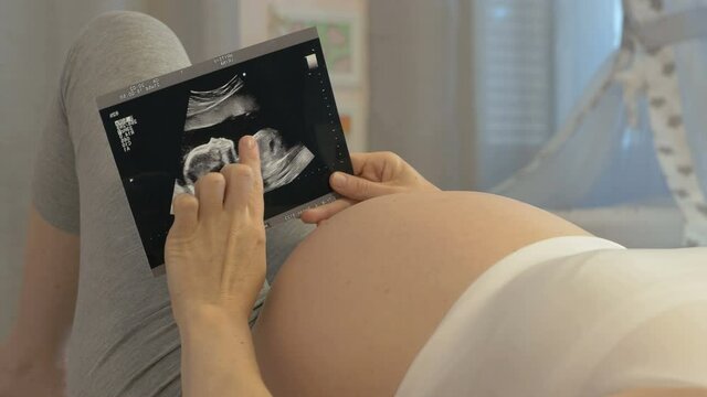 Ultrasound image in the hands of a pregnant young woman. A pregnant woman looks at ultrasound scan of her baby. Cozy home decor with a crib in the background