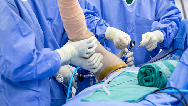 Close up photo of Keyhole surgery.Shoulder joint arthroscopy was perform in modern operating room. Surgeon doctor doing advance surgery with camera. Selective focus and shallow DOF.Medical concept.