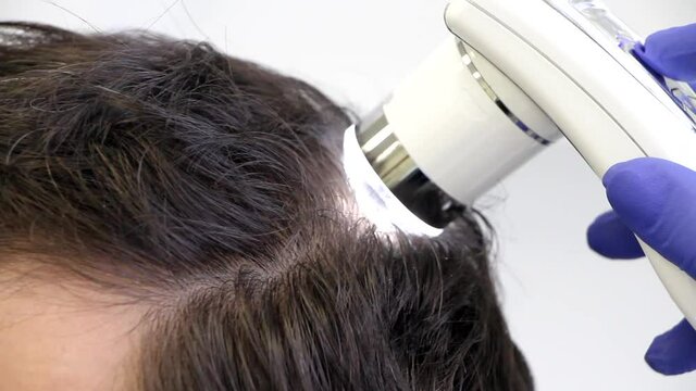 Beautician examines male hairs on the head. Men's cosmetology. Trichology - treatment of baldness. 