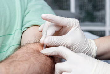 hands of a phisiotherapist making dry puncture