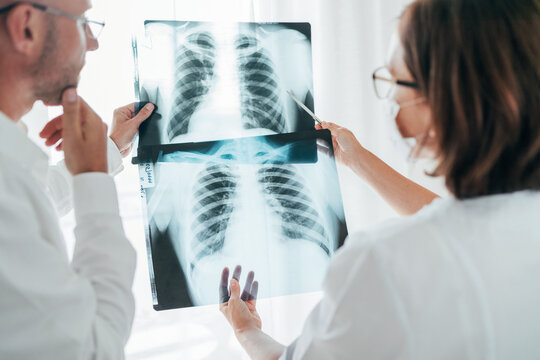 Male doctor and young female colleague examining patient chest x-ray film lungs scan at radiology department in hospital. Covid-19 xray test, worldwide virus epidemic covid spreading concept image.