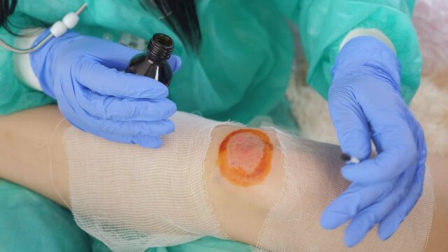 A woman treats the wound with a cotton swab soaked in iodine on the knee of a teenage girl.