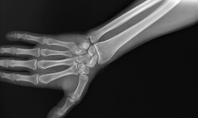 radiograph of the wrist joint and hand of an adult