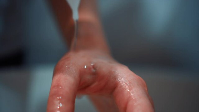 girl pours peroxide on an open wound