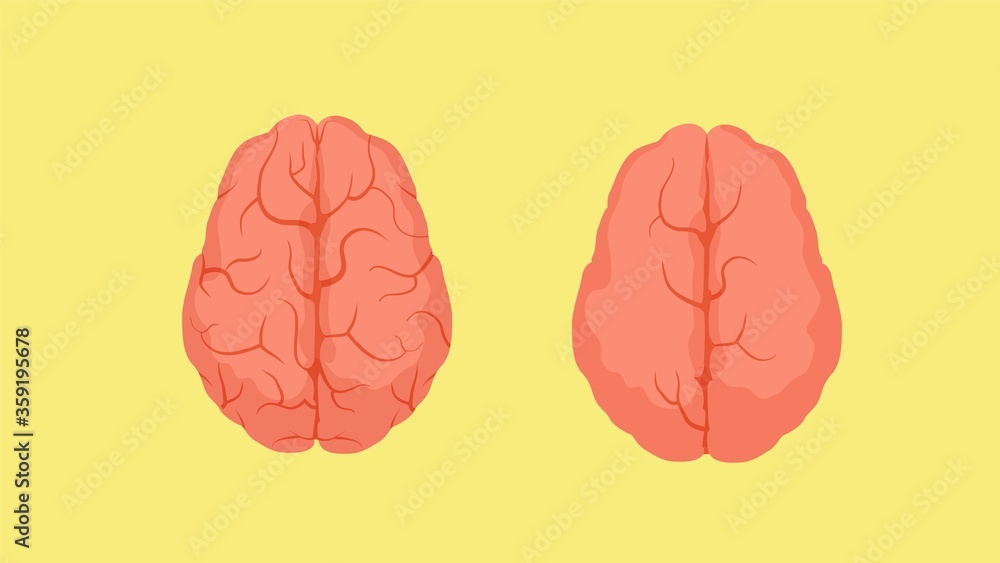 Poster structure of smart human brain and stupid. two red crinkle brains one densely covered convolutions s