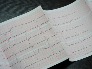 Electrocardiography of a heart on white paper with red cells, close-up at an angle.