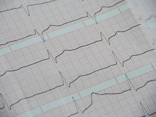 Electrocardiography of a heart on white paper with red cells, close-up at an angle.