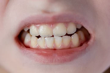 Fotobehang Girl's mouth with white teeth © Albert Ziganshin