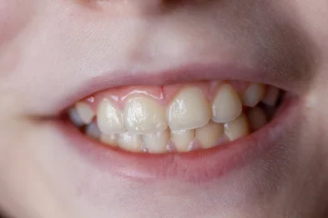 Crédence de cuisine en verre imprimé Doux monstres Portrait en gros plan d& 39 une fille de 9 ans aux dents blanches