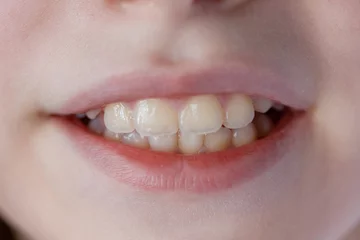 Fotobehang Cute young girl health teeth close up and charming smile.  © Albert Ziganshin