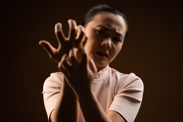 Asian woman was sick with irritate itching her skin standing isolated on beige background.