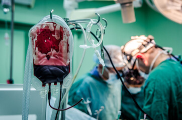 A bag of donated blood used during surgery against a background of a team of surgeons.