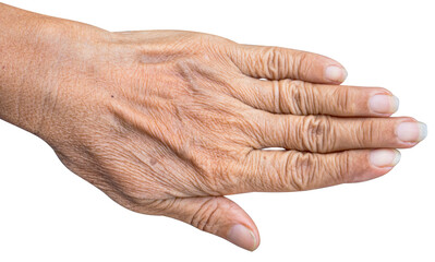 The back of the hand on an old Asian woman solated white background, close up.