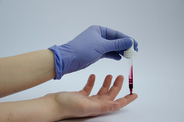 Naklejka premium Blood test blood sampling with finger pipette in purple gloves