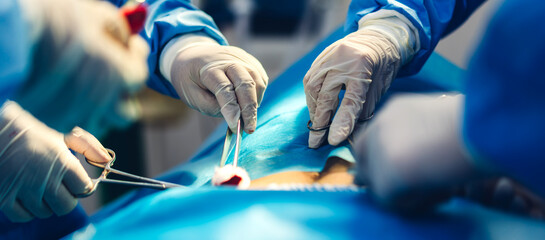 Professional anesthesiologist doctor medical team and assistant preparing patient to gynecological surgery performing operating with surgery equipment in modern hospital operation emergency room