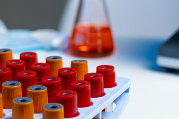 Blood test tubes in lab close up